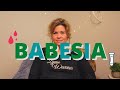 Babesia A Co Infection Of Lyme Disease 