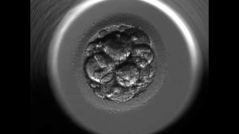 Single Embryo Transfer