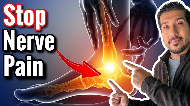 Neuropathy Nerve Pain RELIEF | Top 5 Supplements for Peripheral Neuropathy