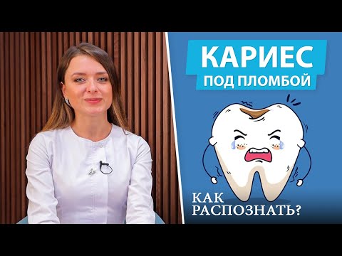 Кариес под пломбой: невидимое вторжение (вторичный кариес)