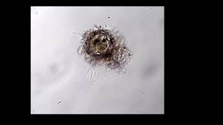 20260504 Testate Amoeba