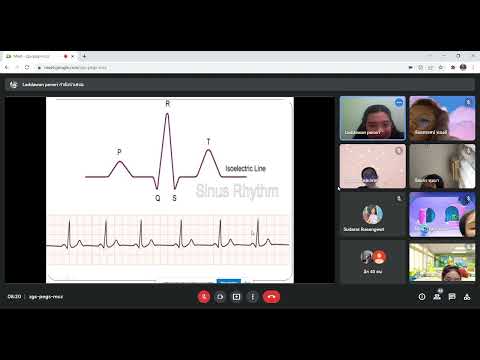 cardiac arrthymia