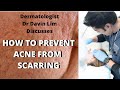 How to prevent ACNE SCARS