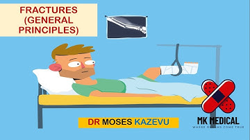 Fractures (General Principles)