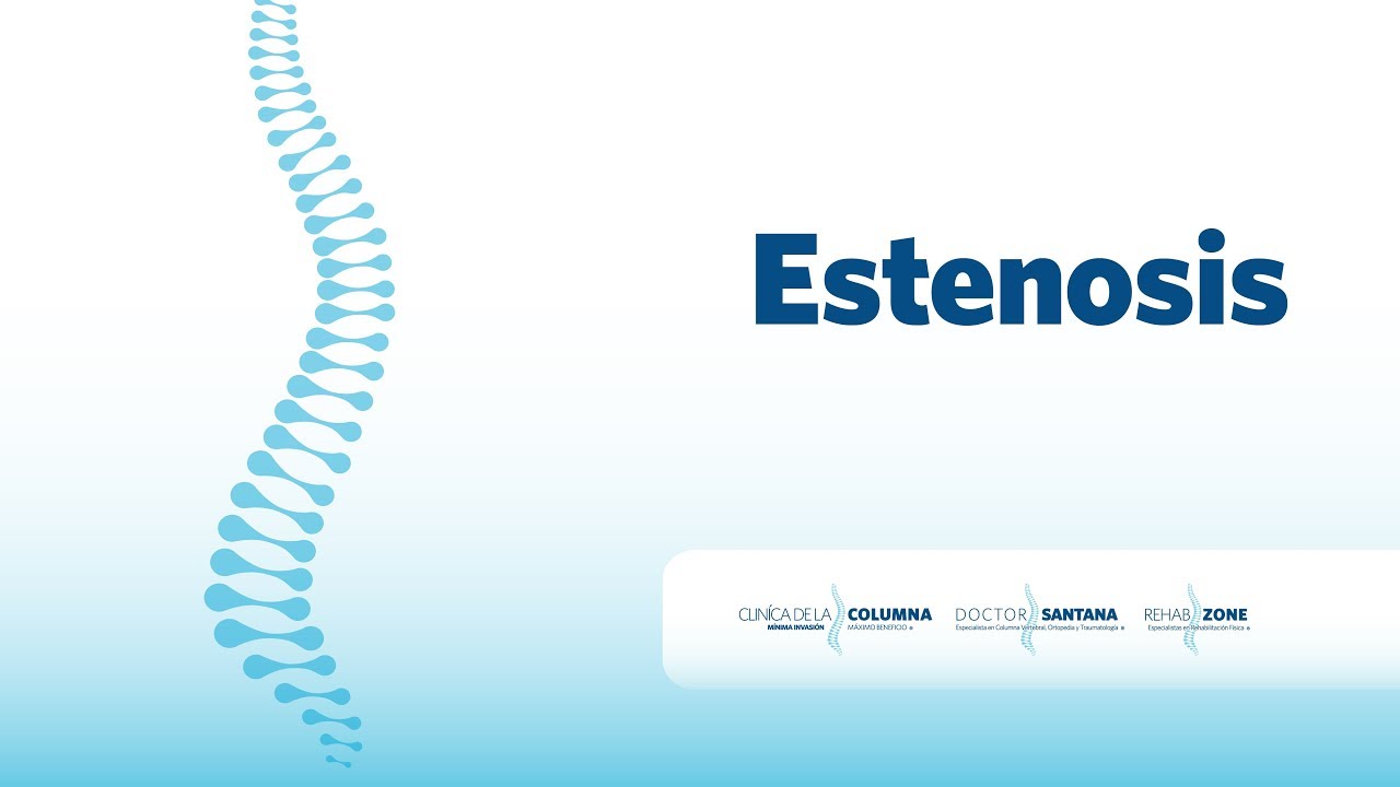 tampa Clínica de la Columna - Escoliosis - Dr. Santana
