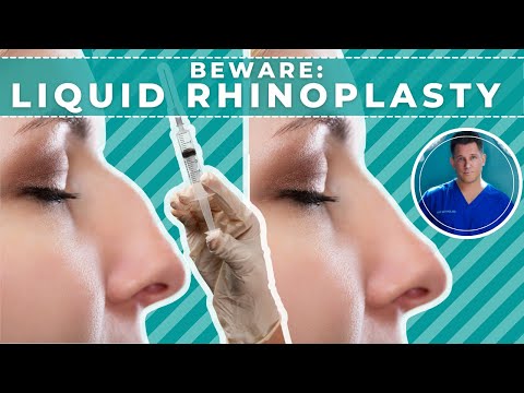 Video thumbnail: NON-SURGICAL NOSE JOB: What can go wrong!