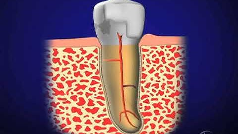 Shape Clean Pack: Rationale for Treatment - Rationale Treatment: Dr. Ruddle Advanced Endodontics