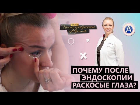 Эндоскопическая подтяжка. Комплексное омоложение лица