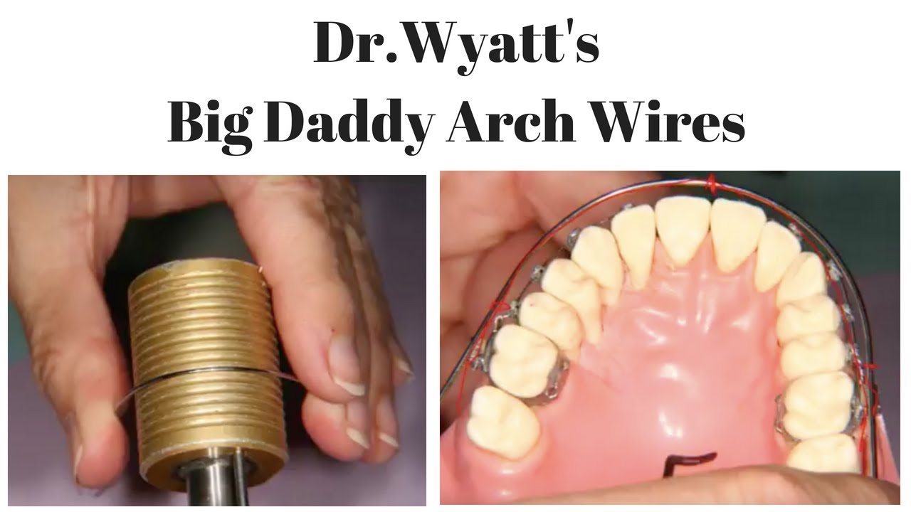 Dr.Wyatt's Big Daddy Arch Wires