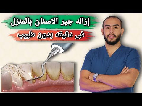 إزالة جير الاسنان فى المنزل بدون طبيب 👌💯 | 7 طرق طبيعية لإزالة جير الاسنان 💥🦷