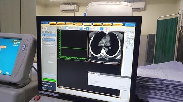 Full work on CT Philips  machine of angiography of Neck and brain