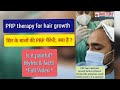 Prp therapy for hair loss  platelet rich plasma therapy 3  grace clinic dehradun