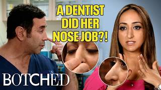 Elmira's DENTIST Did Her Nose Job While Removing Her Wisdom Teeth?! (Before & After) | Botched | E!