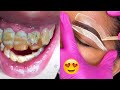 Most Extreme Beauty Treatments 2022 Best Smart and Helpful Beauty Hacks | Virtual Beauty