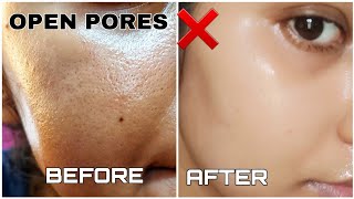 Open Pores Treatment Naturally at Home - Korean Beauty Secrets For Open Pores | the indian girl