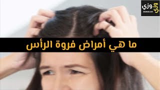 أهم أمراض فروة الرأس يوتيوب