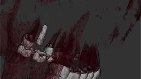 Realtime volume rendering