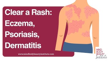 Clear a Rash: Eczema, Psoriasis, Dermatitis