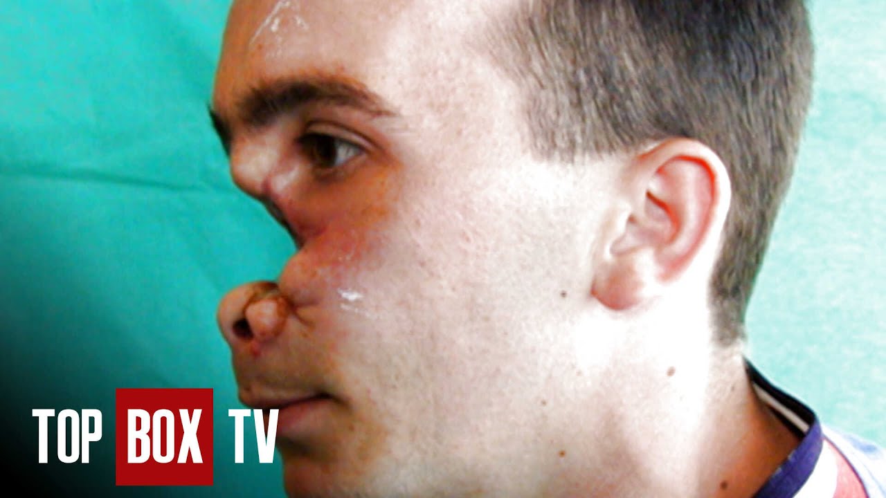 Rare Disease Threatens Life - Amazing Medical Stories - Rebuilding