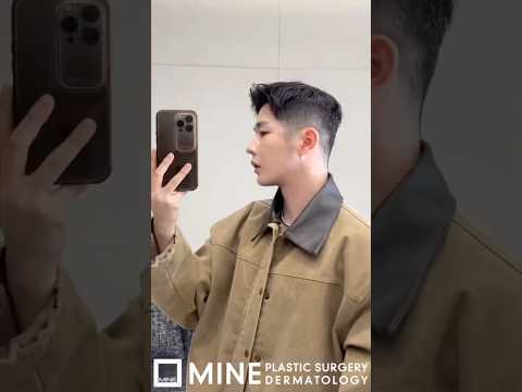 How I Transformed My Jawline In Just Days! #shorts