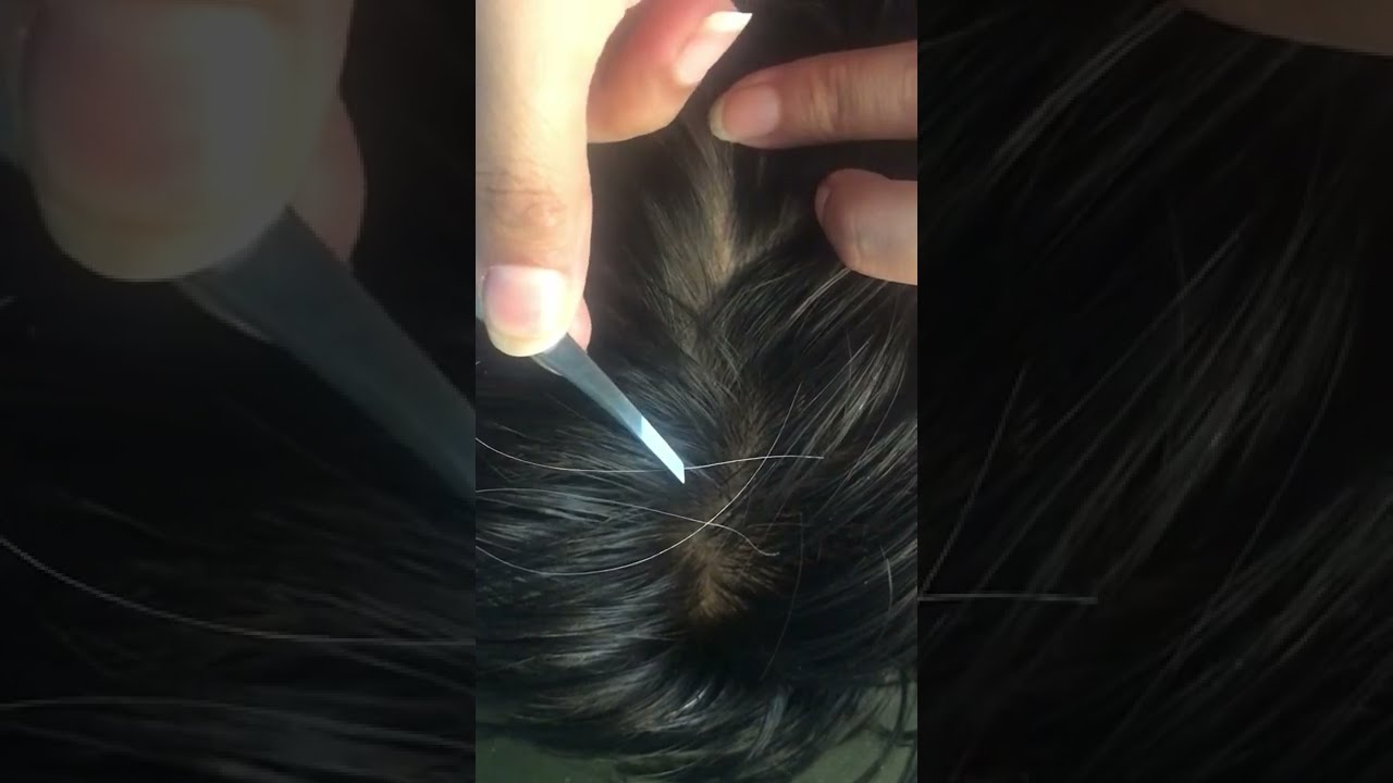 How to get rid white hair removal_ plucking white hair removal_white ...