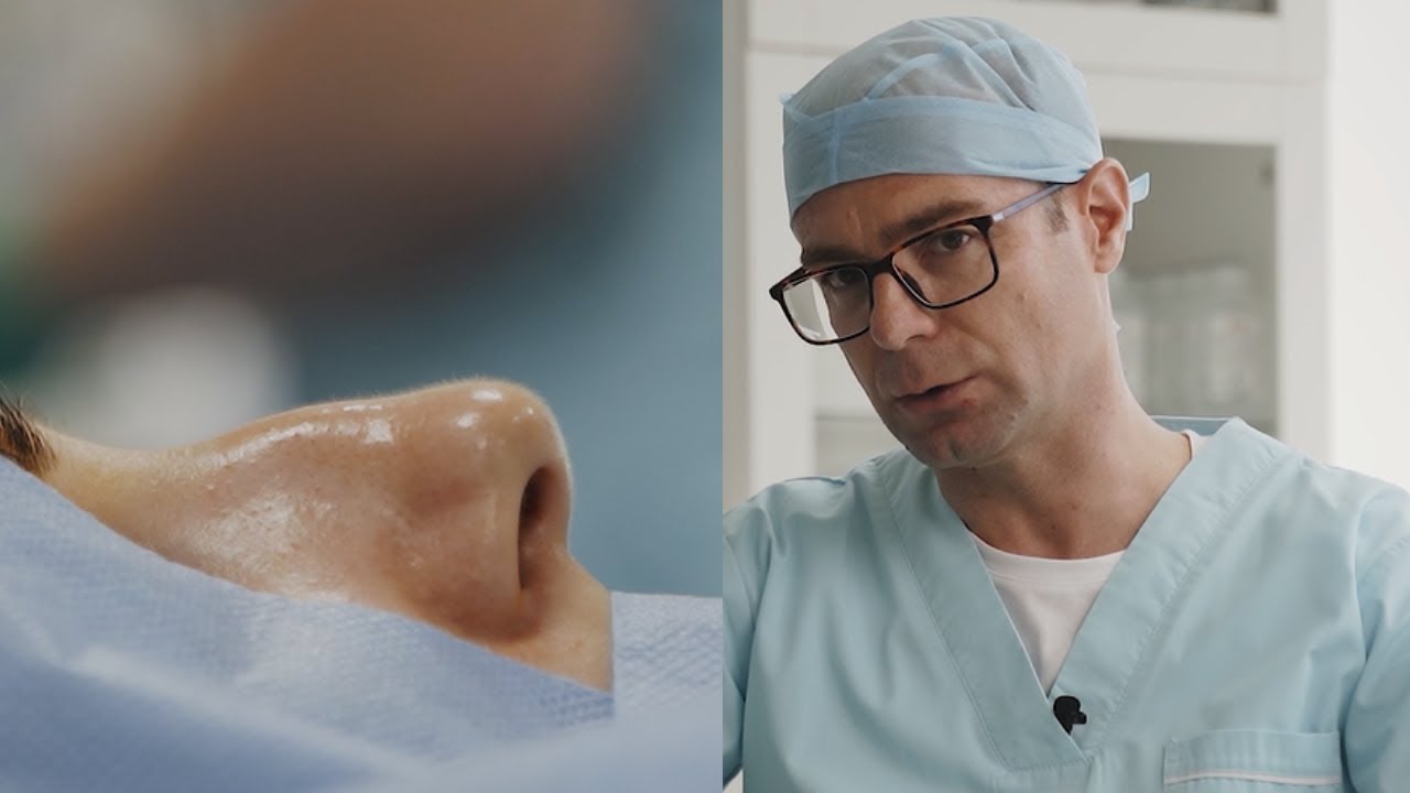 Rinoplastie - Dr. Ursăchescu Cosmin - Clinica Angi San