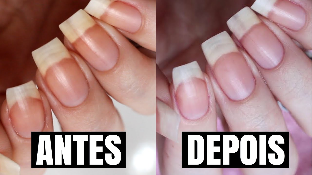 COMO TIRAR O AMARELO DAS UNHAS - YouTube