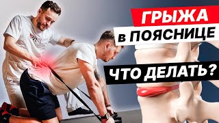 ГРЫЖА ПОЗВОНОЧНИКА - ЧТО ДЕЛАТЬ? ТОП 5 упражнений от БОЛИ В СПИНЕ и ПОЯСНИЦЕ.