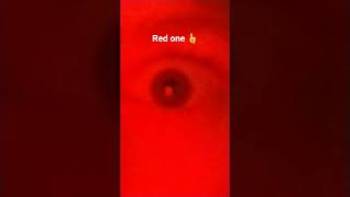 Are Eyes Still Going Viral?