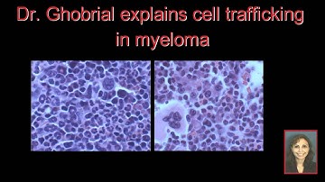 Significance of the Tumor Microenvironment in Hematological Malignancies