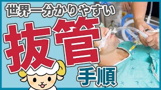 抜管の手順【呼吸器内科医が実演解説】