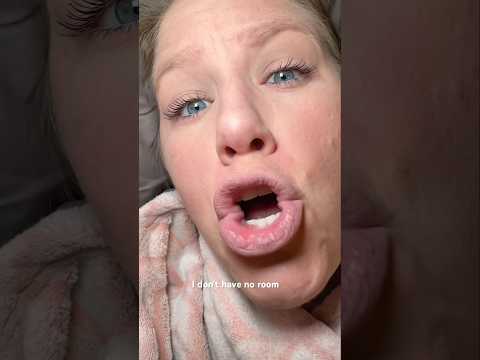 This Was Unnecessary AI Assisted Video Using OpenAI Sora Funny Comedy Shorts 