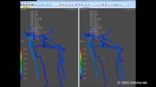 Development of an integrated 1D-0D simulation system for patient-specific cerebral circulation