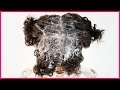 How To Make Black Hair Grow FASTER & LONGER!