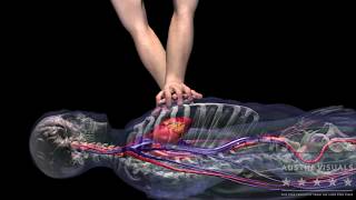 Chest Compression. Austin Visuals