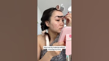 How I do my makeup without covering my acne ☺️🎀 #acnefree #acne #viral #makeup