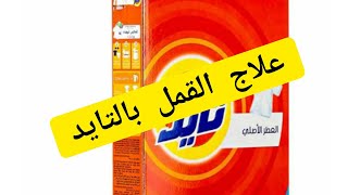 وداعا للقمل والصيبان عند الأطفال