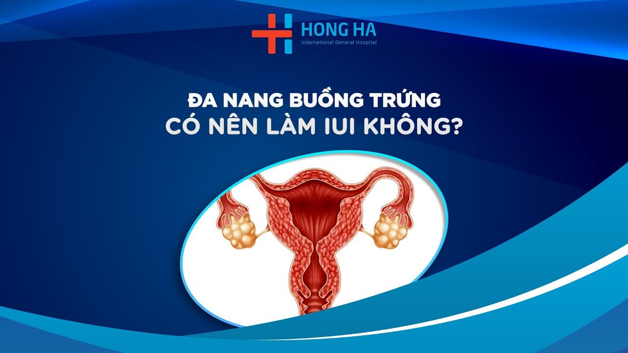 Giải Đáp Thắc Mắc Về Thụ Tinh Nhân Tạo IUI | BVĐK Hồng Hà