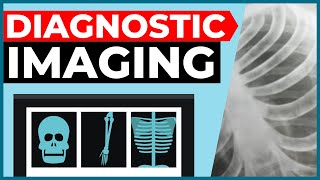 Diagnostic Imaging Explained (XRay / CT Scan / Ultrasound / MRI)