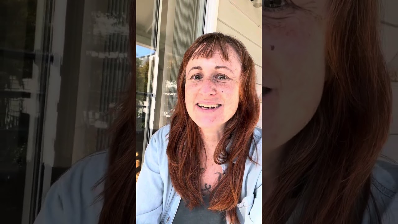 Update. It ain’t pretty folks! Healing and recovery.