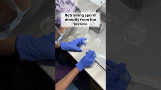 Retrieving sperm from testis!!
