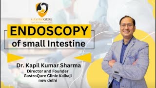 Endoscopy Of Small Intestine | Kapil Sharma Best Gastroenterologist