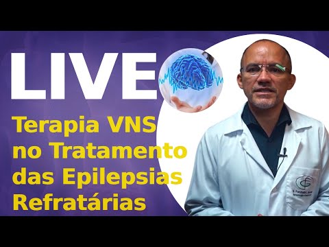 Live #005 - Terapia VNS no Tratamento das Epilepsias Refratárias