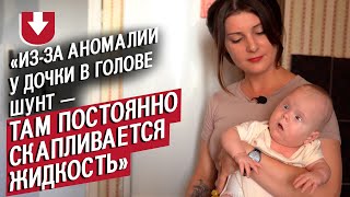 У моей дочери спина Бифида: Вероника | Быть мамой