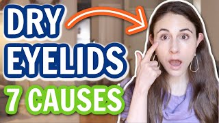 7 REASONS FOR DRY EYELIDS | Dermatologist @DrDrayzday Eyelids Are Dry