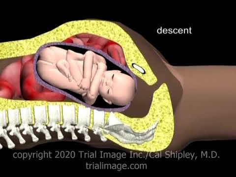 Normal Vaginal Delivery (movement through the birth canal) Animation by Cal  Shipley, . - YouTube