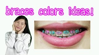 Braces Colors Ideas!