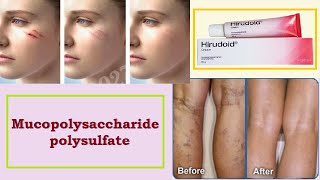 Mucopolysaccharide Polysulfate