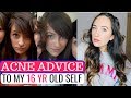 ACNE ADVICE TO MY TEENAGE SELF | What I Wish I Knew