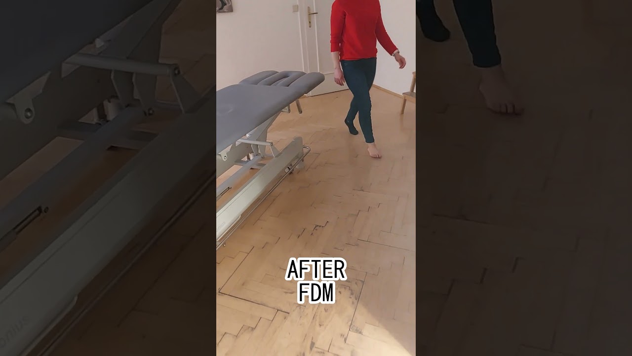 Sprained Ankle Treatment (Quick Fix)